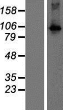 Novus Biologicals&trade;&nbsp;DGK-theta Overexpression Lysate