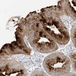 DGK-theta Antibody, Novus Biologicals:Antibodies:Primary Antibodies