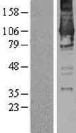 Novus Biologicals&trade;&nbsp;DGK-zeta Overexpression Lysate