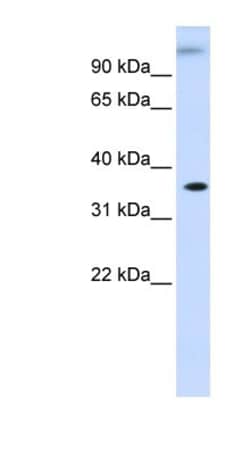 DHDH Antibody, Novus Biologicals 100&mu;L; Unlabeled:Antibodies, Polyclonal