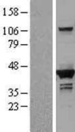 Novus Biologicals&trade;&nbsp;DHPS Overexpression Lysate
