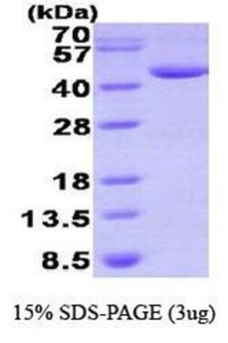 Novus Biologicals&trade;&nbsp;Recombinant Human DHPS His Protein