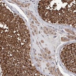 DHPS Antibody, Novus Biologicals:Antibodies:Primary Antibodies