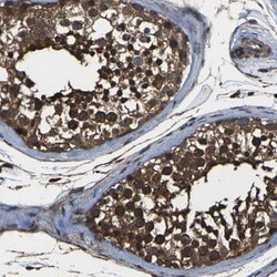 DHPS Antibody, Novus Biologicals 0.1mL; Unlabeled:Antibodies, Polyclonal