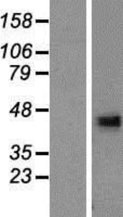 Novus Biologicals™ DHRS13 Overexpression Lysate