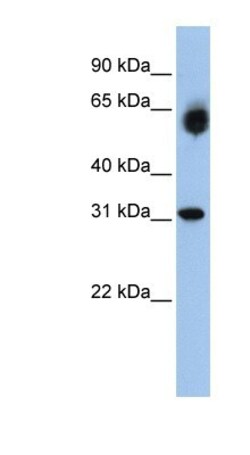 DHRS2 Antibody, Novus Biologicals 100&mu;L; Unlabeled:Antibodies, Polyclonal