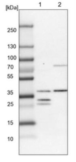 DHRS3 Antibody, Novus Biologicals 25 &mu;L; Unlabeled:Antibodies, Polyclonal