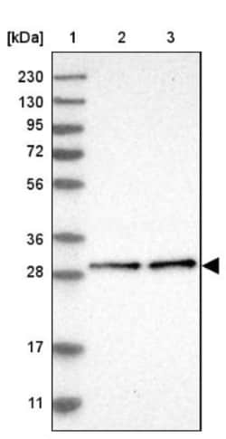 DHRS4 Antibody, Novus Biologicals 0.1 mL | Buy Online | Novus Biologicals | Fisher Scientific
