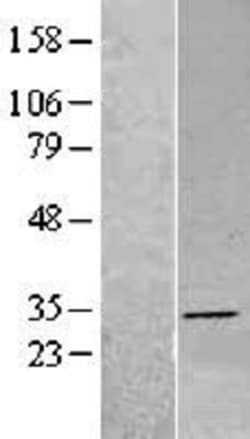 Novus Biologicals&trade;&nbsp;DHRS4 Overexpression Lysate