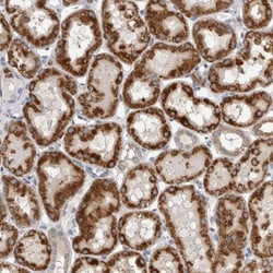 DHRS4 Antibody, Novus Biologicals 0.1 mL | Buy Online | Novus Biologicals | Fisher Scientific