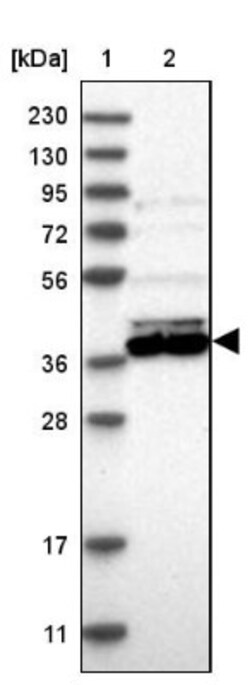 DHRS7 Antibody, Novus Biologicals:Antibodies:Primary Antibodies