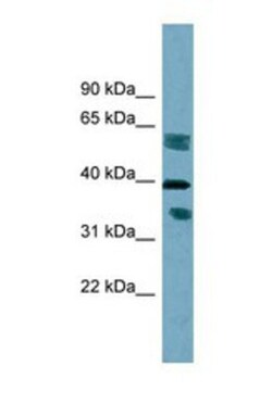 DHRS7B Antibody, Novus Biologicals 0.05mg; Unlabeled:Antibodies, Polyclonal