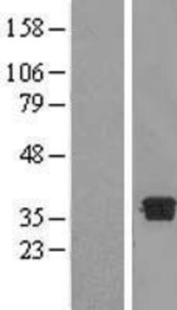Novus Biologicals&trade;&nbsp;DHRS7B Overexpression Lysate