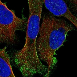 DHRS9 Antibody, Novus Biologicals:Antibodies:Primary Antibodies