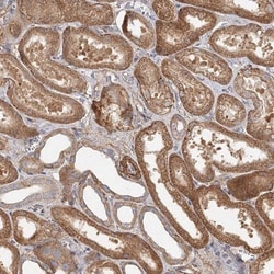 DHRS9 Antibody, Novus Biologicals:Antibodies:Primary Antibodies