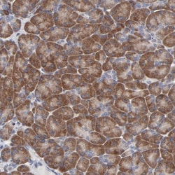 DHRSX Antibody, Novus Biologicals 0.1 mL | Buy Online | Novus Biologicals | Fisher Scientific