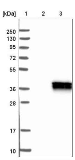 DHRSX Antibody, Novus Biologicals 0.1 mL | Buy Online | Novus Biologicals | Fisher Scientific