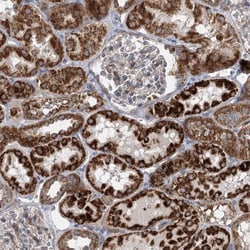 DHTKD1 Antibody, Novus Biologicals:Antibodies:Primary Antibodies