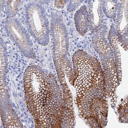 DHX34 Antibody, Novus Biologicals 25 &mu;L | Buy Online | Novus Biologicals | Fisher Scientific