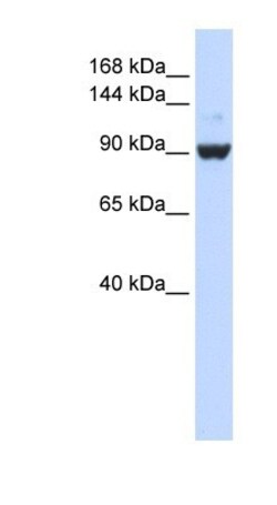 DHX34 Antibody, Novus Biologicals 100&mu;L; Unlabeled:Antibodies, Polyclonal