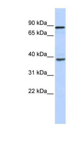 DHX35 Antibody, Novus Biologicals 20&mu;L; Unlabeled:Antibodies, Polyclonal