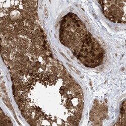 DHX36 Antibody, Novus Biologicals 0.1mL; Unlabeled:Antibodies, Polyclonal