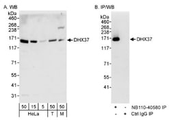 DHX37 Antibody, Novus Biologicals 0.1mL; Unlabeled:Antibodies, Polyclonal