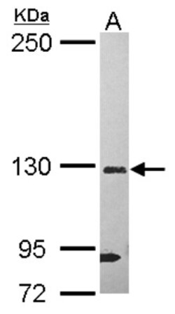 DHX37 Antibody, Novus Biologicals 0.1mL; Unlabeled:Antibodies, Polyclonal