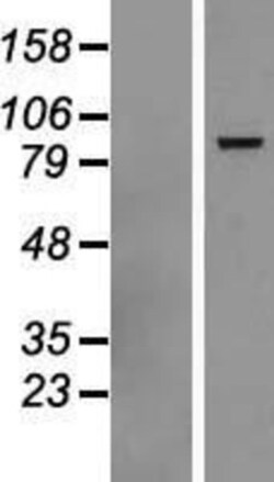 Novus Biologicals™ DHX58 Overexpression Lysate