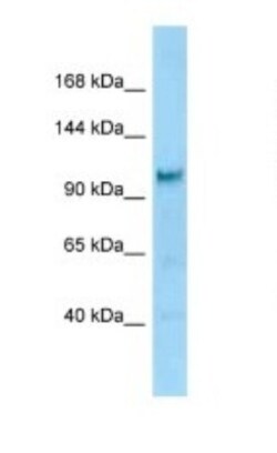 DIAPH-2 Antibody, Novus Biologicals 100&mu;L; Unlabeled:Antibodies, Polyclonal