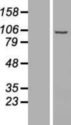 Novus Biologicals&trade;&nbsp;DIEXF Overexpression Lysate