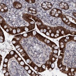 DIEXF Antibody, Novus Biologicals 0.1mL; Unlabeled:Antibodies, Polyclonal