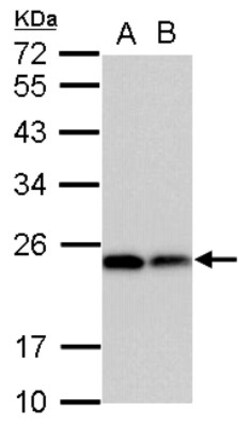 Dihydrofolate Reductase/DHFR Antibody, Novus Biologicals 0.1mL; Unlabeled:Antikroppar