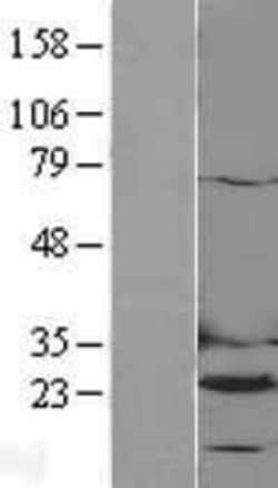 Novus Biologicals&trade;&nbsp;Dihydrofolate Reductase/DHFR Overexpression Lysate