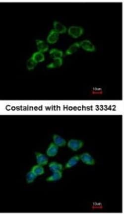 Dimethylarginine Dimethylaminohydrolase 1/DDAH1 Antibody, Novus Biologicals