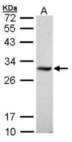Dimethylarginine Dimethylaminohydrolase 1/DDAH1 Antibody, Novus Biologicals