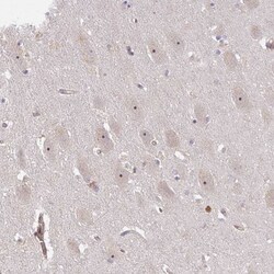 DIMT1L Antibody, Novus Biologicals:Antibodies:Primary Antibodies