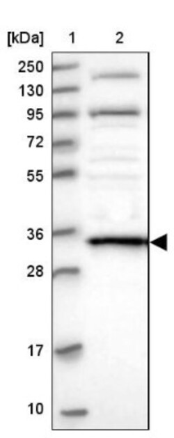 DIMT1L Antibody, Novus Biologicals:Antibodies:Primary Antibodies