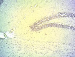 DIO2 Antibody, Novus Biologicals 0.1mg; Unlabeled:Antibodies, Polyclonal