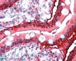 DIO2 Antibody, Novus Biologicals 0.1mg; Unlabeled:Antibodies, Polyclonal