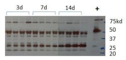 DIO3 Antibody - BSA Free, Novus Biologicals 0.1mL; Unlabeled:Antibodies,
