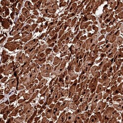 DIP13B Antibody, Novus Biologicals:Antibodies:Primary Antibodies