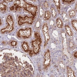 DIP13B Antibody, Novus Biologicals 0.1mL; Unlabeled:Antibodies, Polyclonal