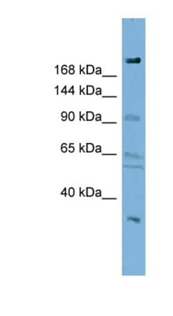 DIP2A Antibody, Novus Biologicals:Antibodies:Primary Antibodies