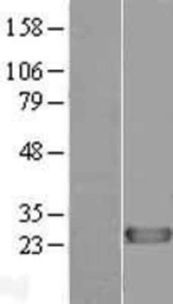 Novus Biologicals™ DIRAS1 Overexpression Lysate