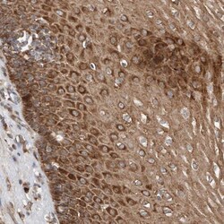 DIRAS3 Antibody, Novus Biologicals 0.1mL; Unlabeled:Antibodies, Polyclonal