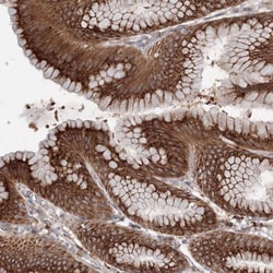 DIS3L2 Antibody, Novus Biologicals:Antibodies:Primary Antibodies