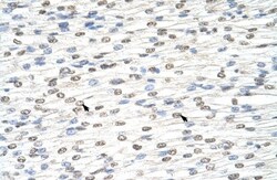 DIS3L2 Antibody, Novus Biologicals:Antibodies:Primary Antibodies
