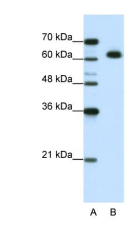 DIS3L2 Antibody, Novus Biologicals:Antibodies:Primary Antibodies