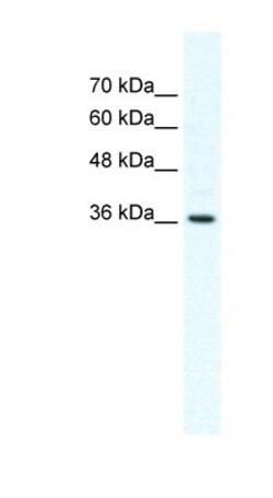 Dishevelled-1 Antibody, Novus Biologicals 0.1mg; Unlabeled:Antibodies,